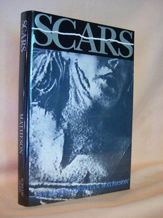 Item #27493 SCARS AND OTHER DISTINGUISHING MARKS. Richard Christian Matheson